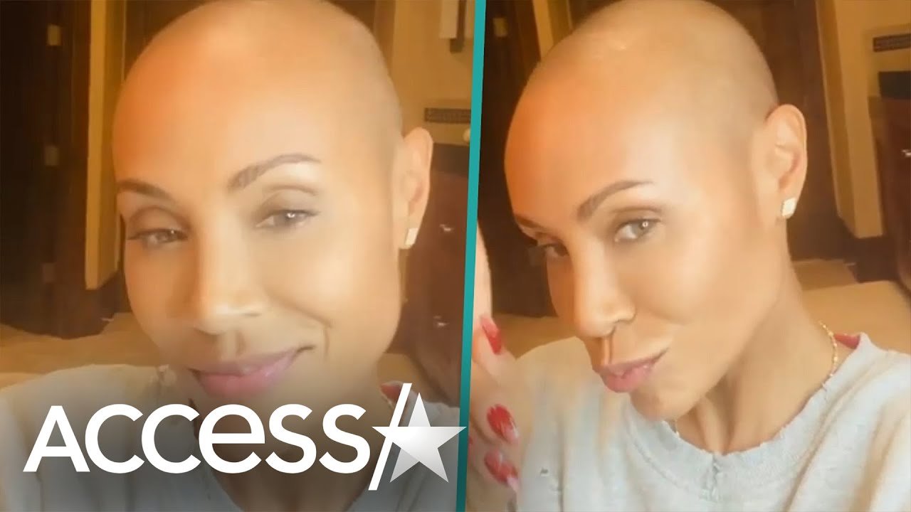 Jada Pinkett Smith Embracing Hair Loss Due To Alopecia