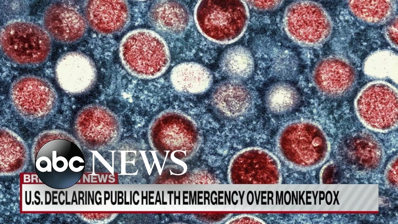 Biden administration declares monkeypox a public health emergency